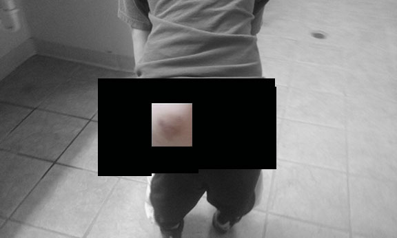 TJW bruised bottom 7-18-15